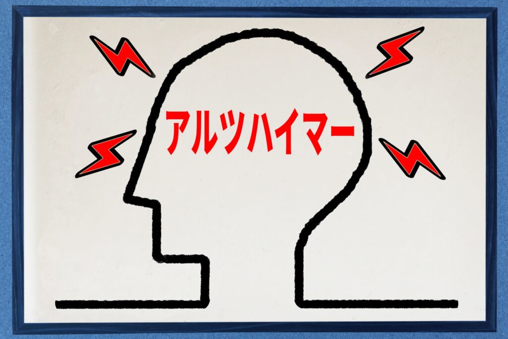 アルツハイマーの症状をイメージした画像
